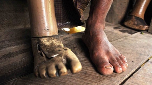 Le fléau des mines antipersonnel en Birmanie